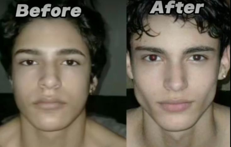 Verified Neck & Posture Transformation
